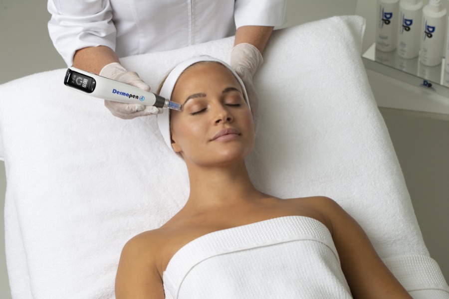 A client receiving a Dermapen microneedling facial treatment